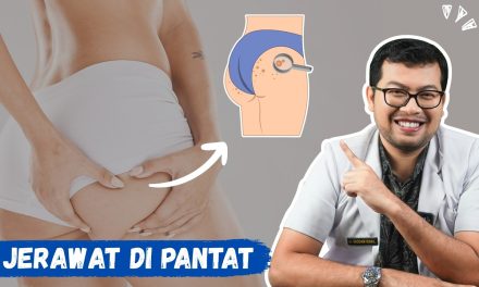Jerawat Di Bokong, Inilah Penyebab Dan Cara Pengobatannya