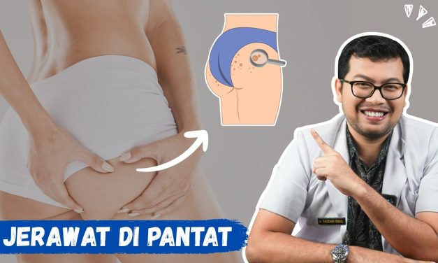Jerawat Di Bokong, Inilah Penyebab Dan Cara Pengobatannya