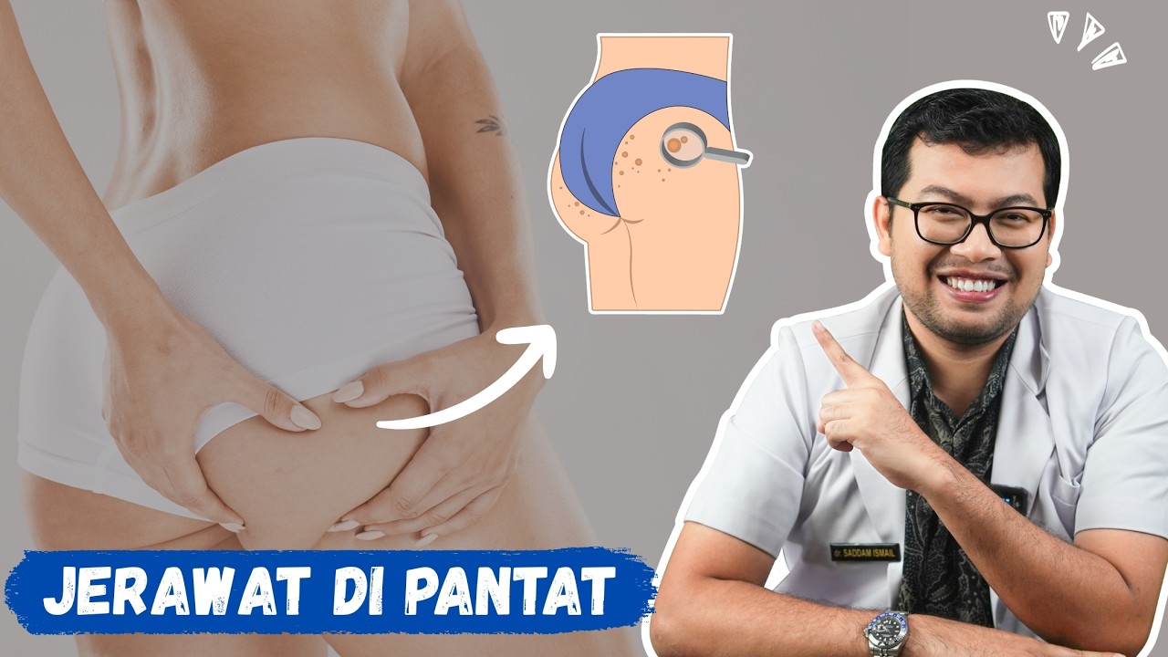 Jerawat